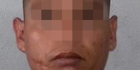 Vinculan a proceso a hombre por probable ataque peligroso en Tamuín