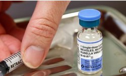 Sarampión en México: Preocupante subida de casos y falta de vacunas para prevenir contagios
