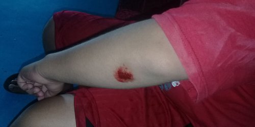 Niño es atropellado por camioneta manejada por hombre ebrio