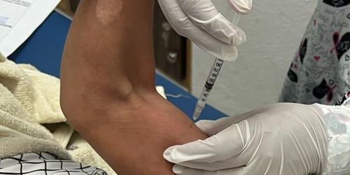 La toxina botulínica transforma vidas en la UBR Maravillas