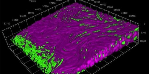 En la guerra bacteriana se producen ataques suicidas masivos