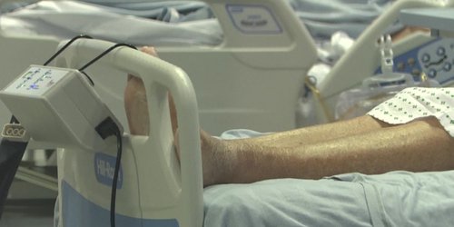 La dexametasona, reduce el riesgo de morir de pacientes de coronavirus más graves, según resultados de Oxford