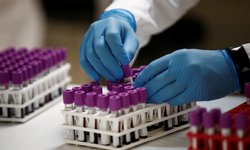 Avanza investigación del IPN en fármaco contra Covid-19