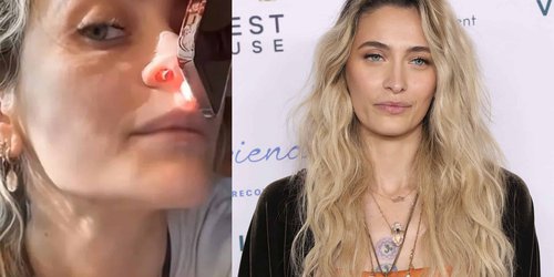 Paris Jackson revela que el consumo de drogas le perforó el tabique nasal