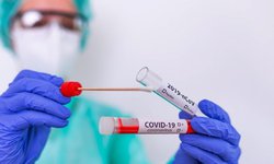 Coepris lleva aseguradas 2 mil pruebas rápidas de covid