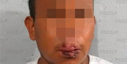 Sentencia de 40 años de prisión a homicida que mató a su hermano