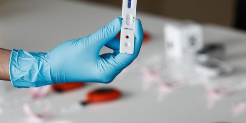 Aún cuando han disminuido casos de Covid, sigue el riesgo de contagio: Salud