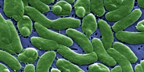 Florida confirma un muerto y 12 afectados por "bacteria carnívora" en el condado de Palm Beach.