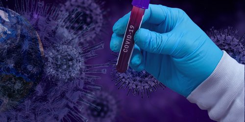 SLP suma 11 mil 038 casos de Coronavirus; 275 nuevos