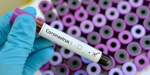 Continúa SLP sin casos de Coronavirus