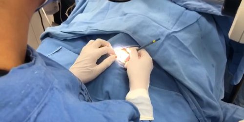 Servicios de Salud reactiva programa de trasplantes